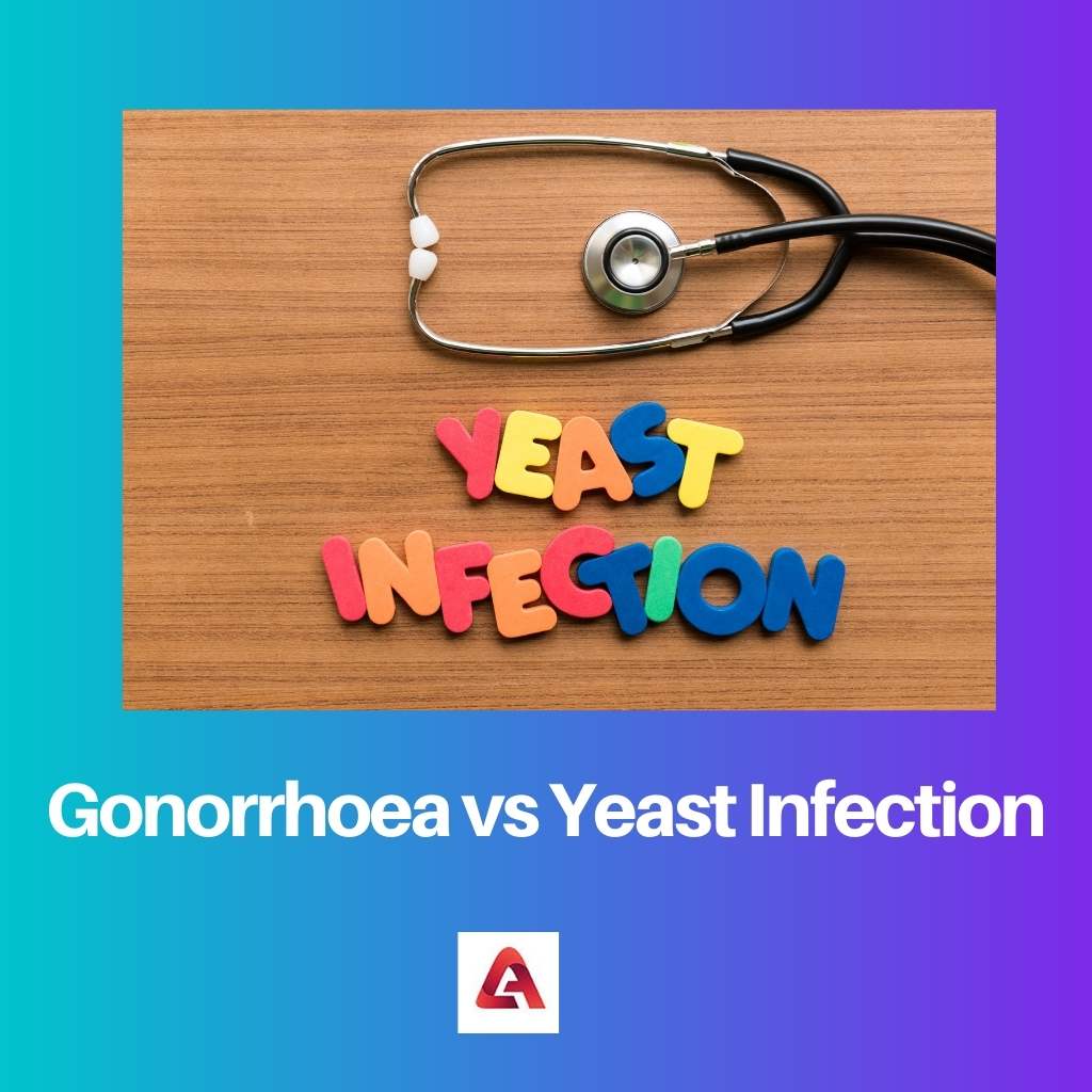 Gonorrhoea vs Yeast Infection