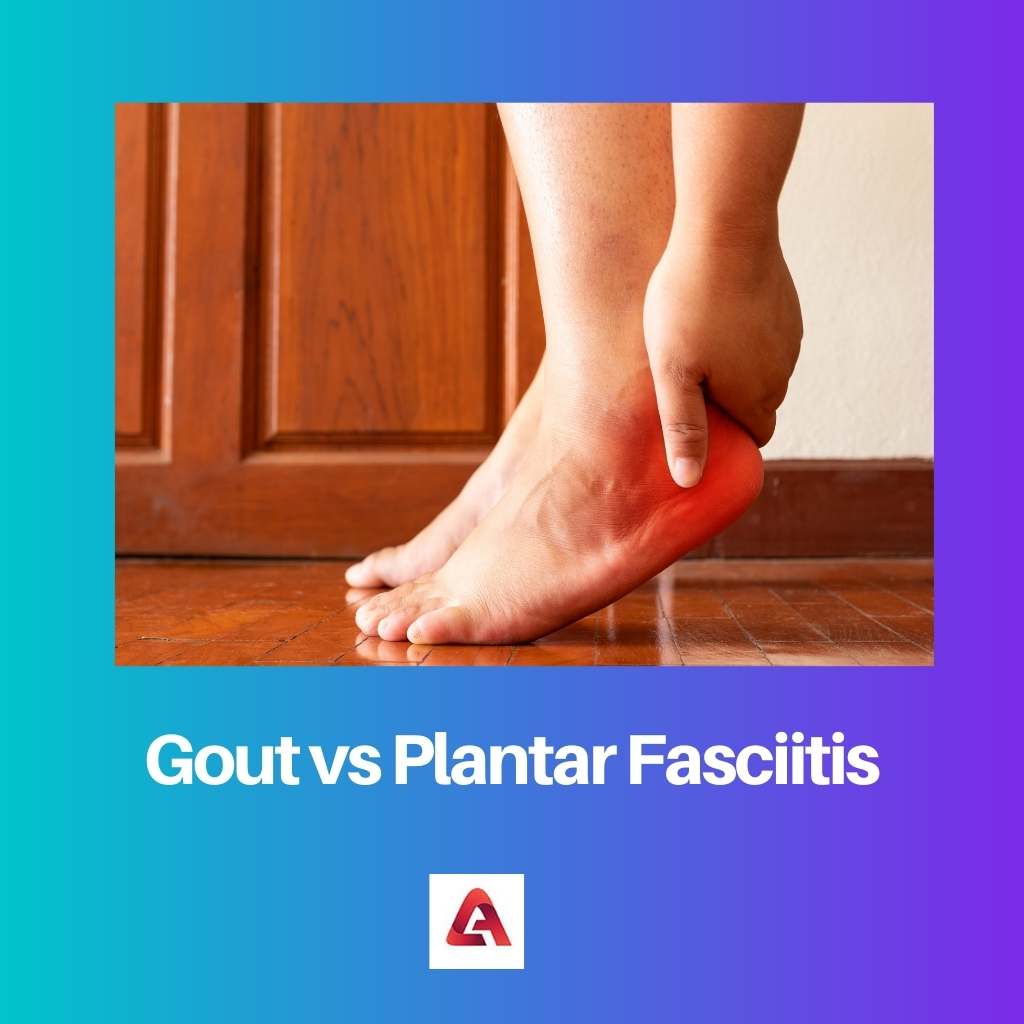 Gout vs Plantar Fasciitis