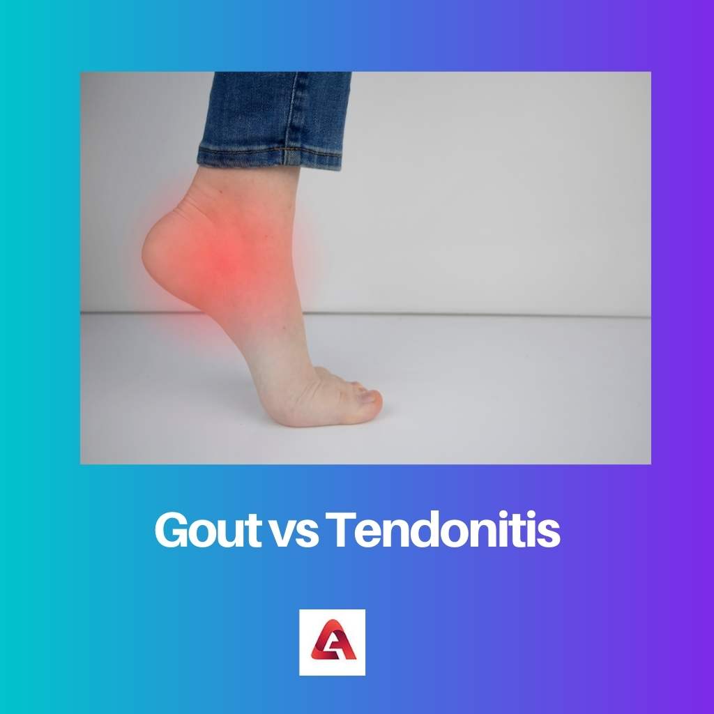Gout vs Tendonitis