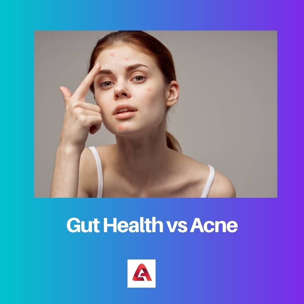 Gut Health vs Acne