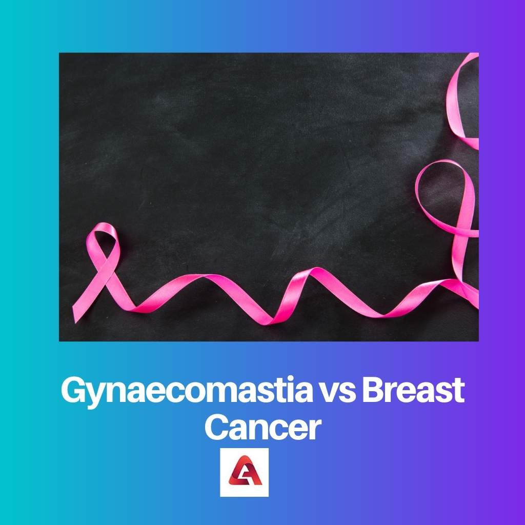 Gynaecomastia vs Breast Cancer