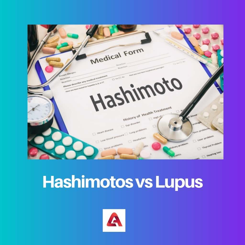 Hashimotos vs Lupus