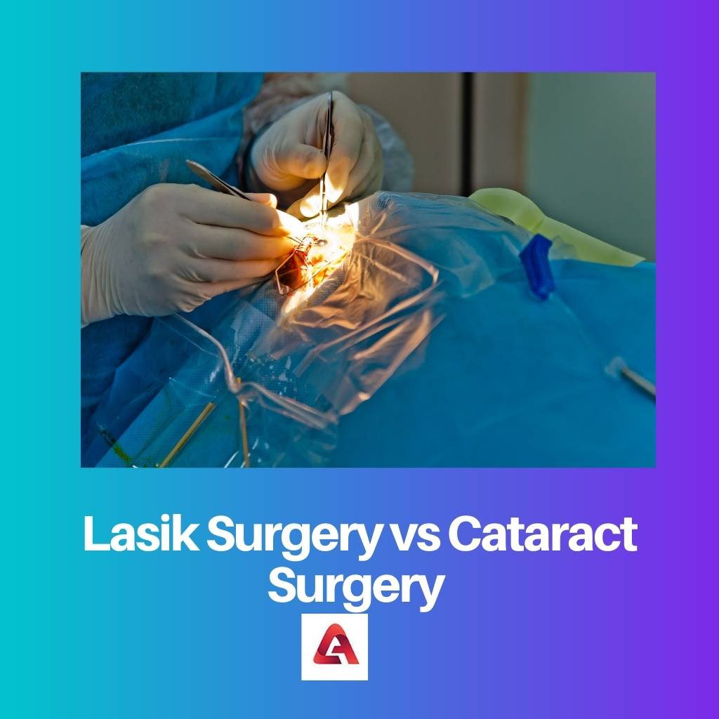 Lasik Surgery vs Cataract Surgery