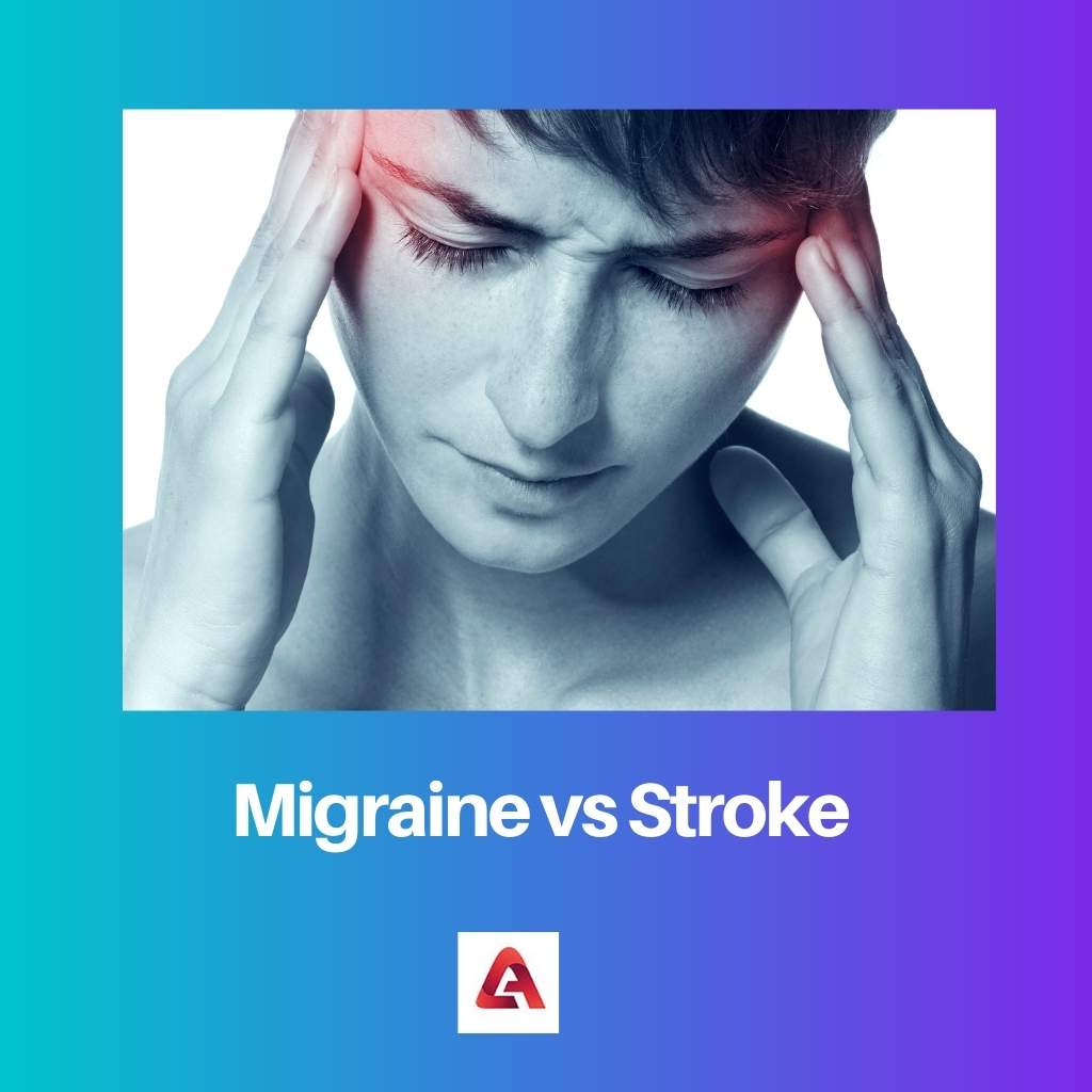 Migraine vs Stroke