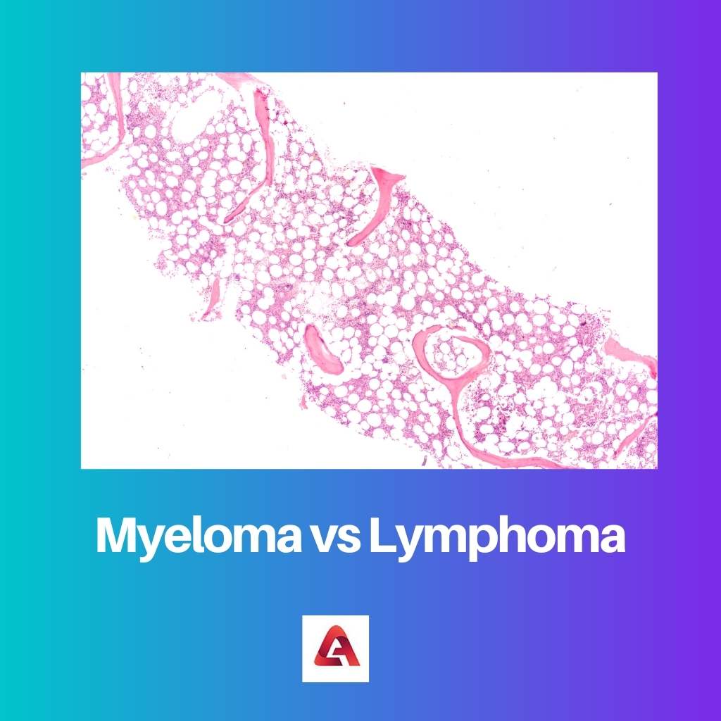 Myeloma vs Lymphoma
