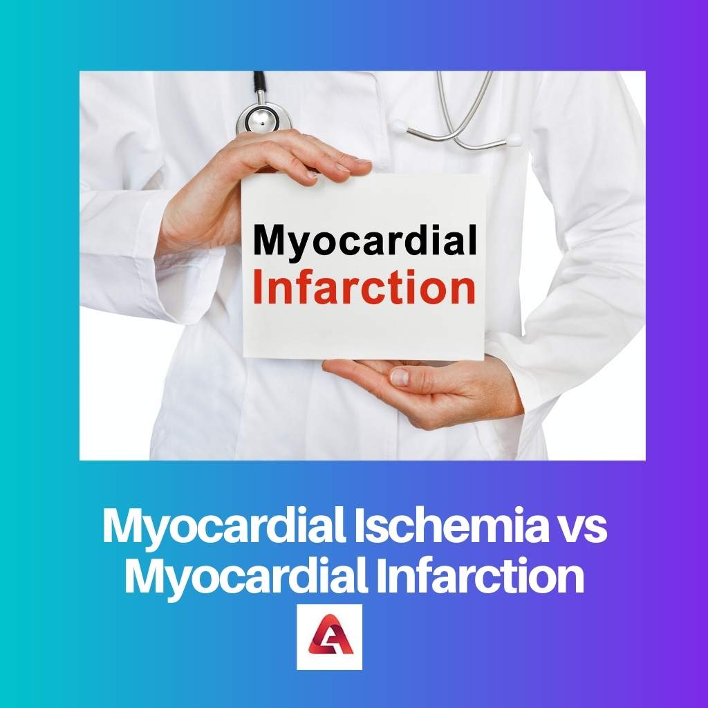Myocardial Ischemia vs Myocardial Infarction