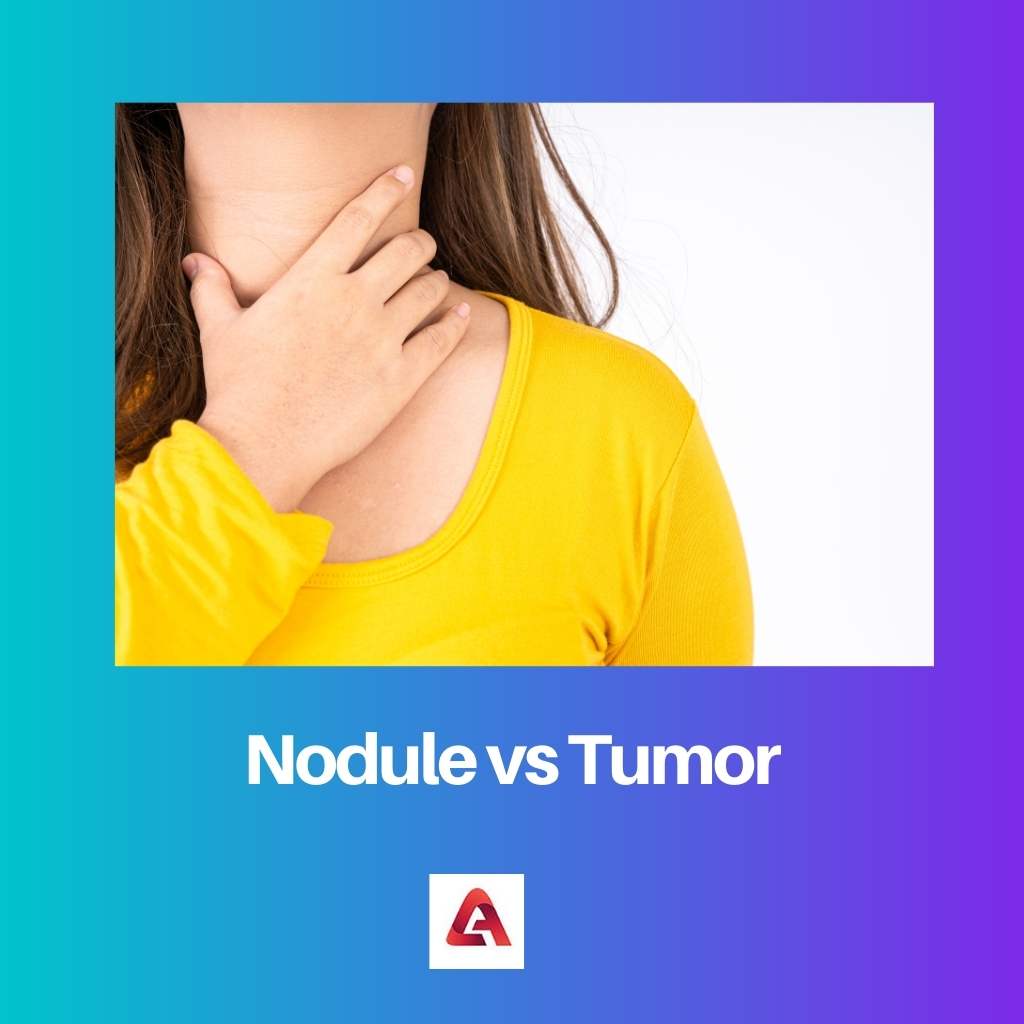Nodule vs Tumor