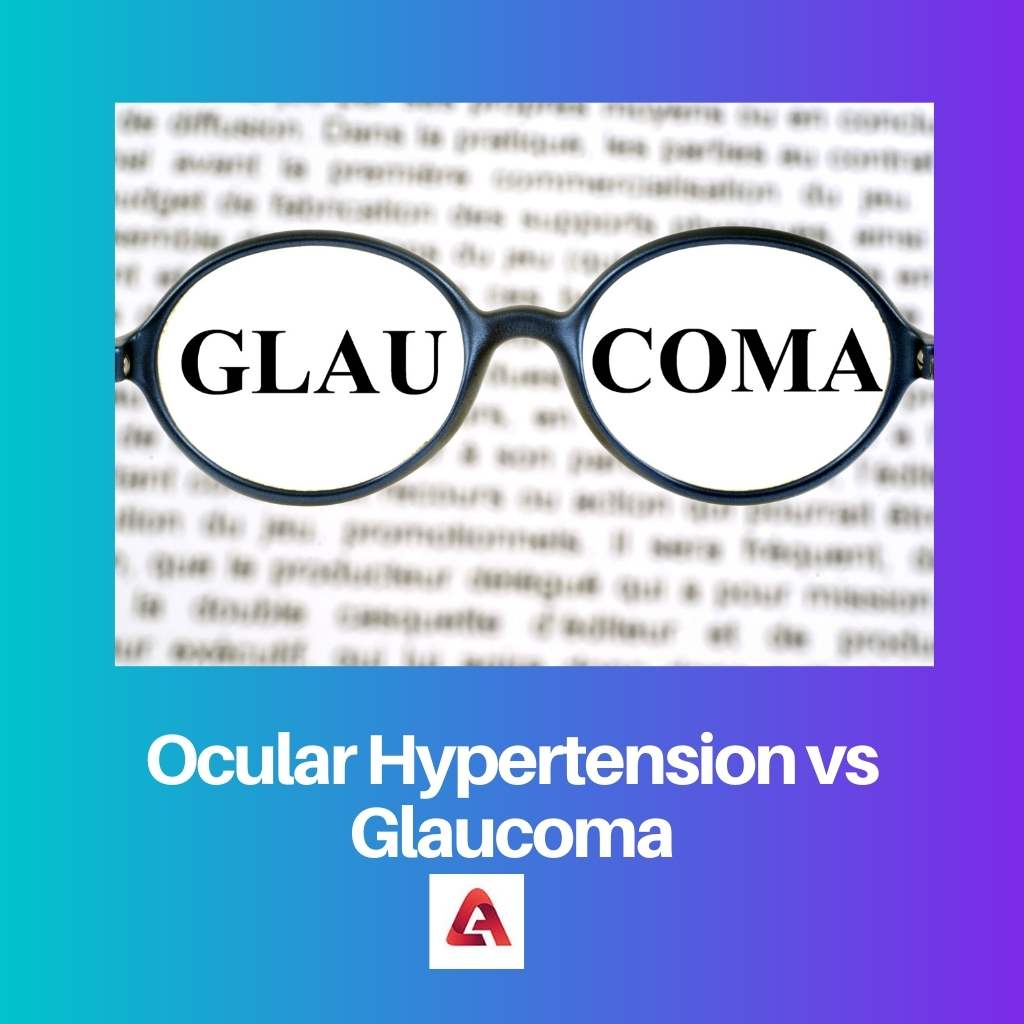 Ocular Hypertension vs Glaucoma