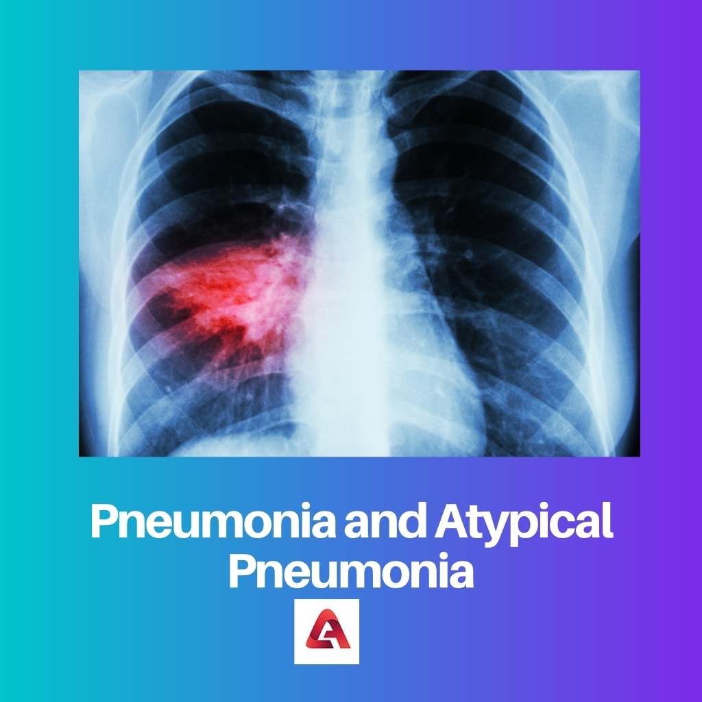 Pneumonia and Atypical Pneumonia
