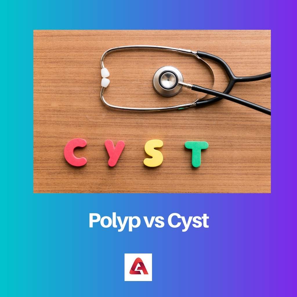 Polyp vs Cyst