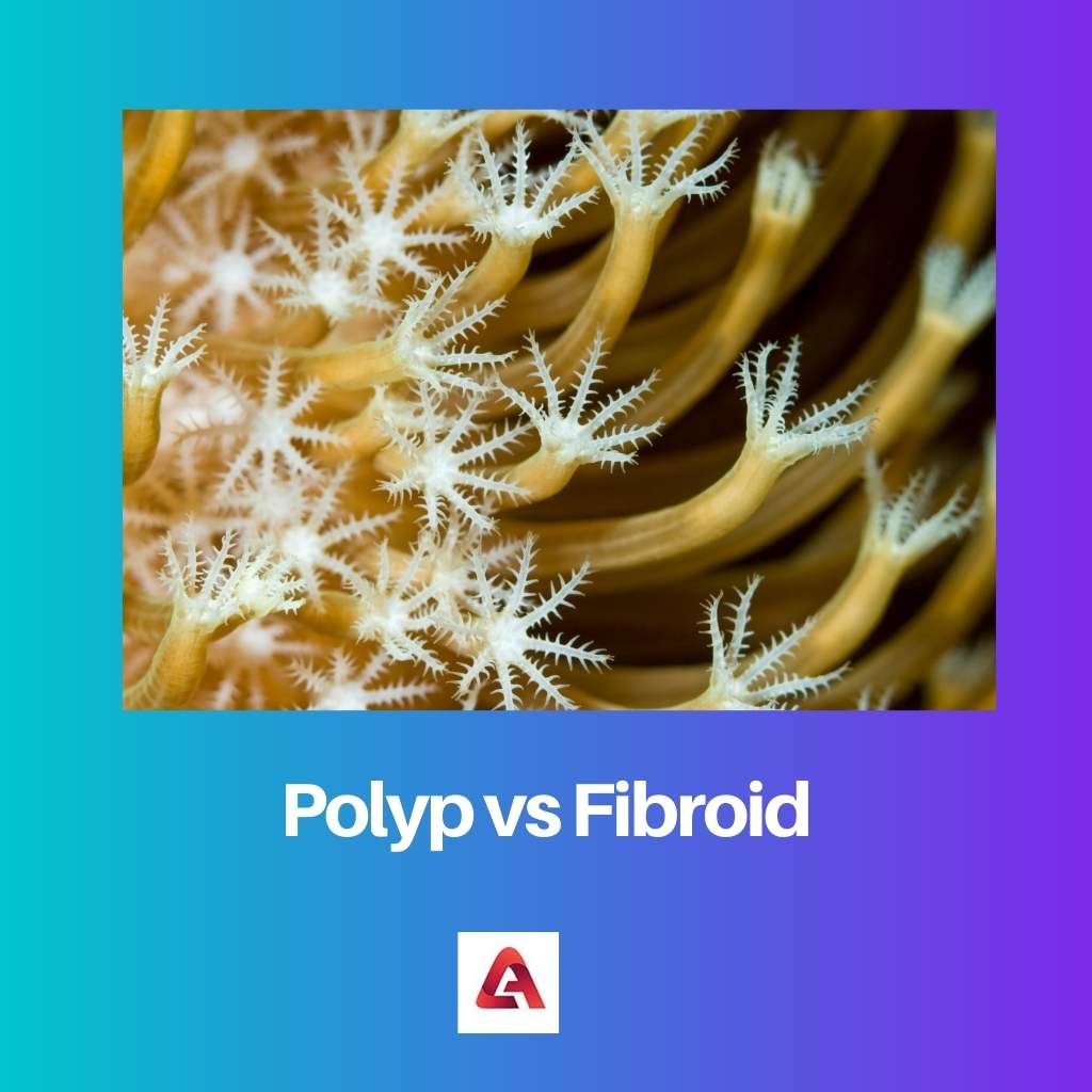 Polyp vs Fibroid