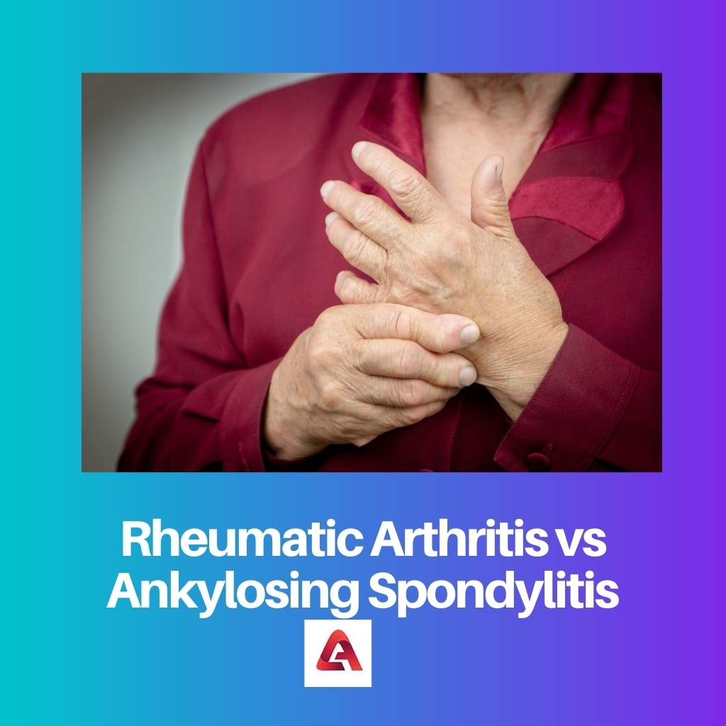 Rheumatic Arthritis vs Ankylosing Spondylitis