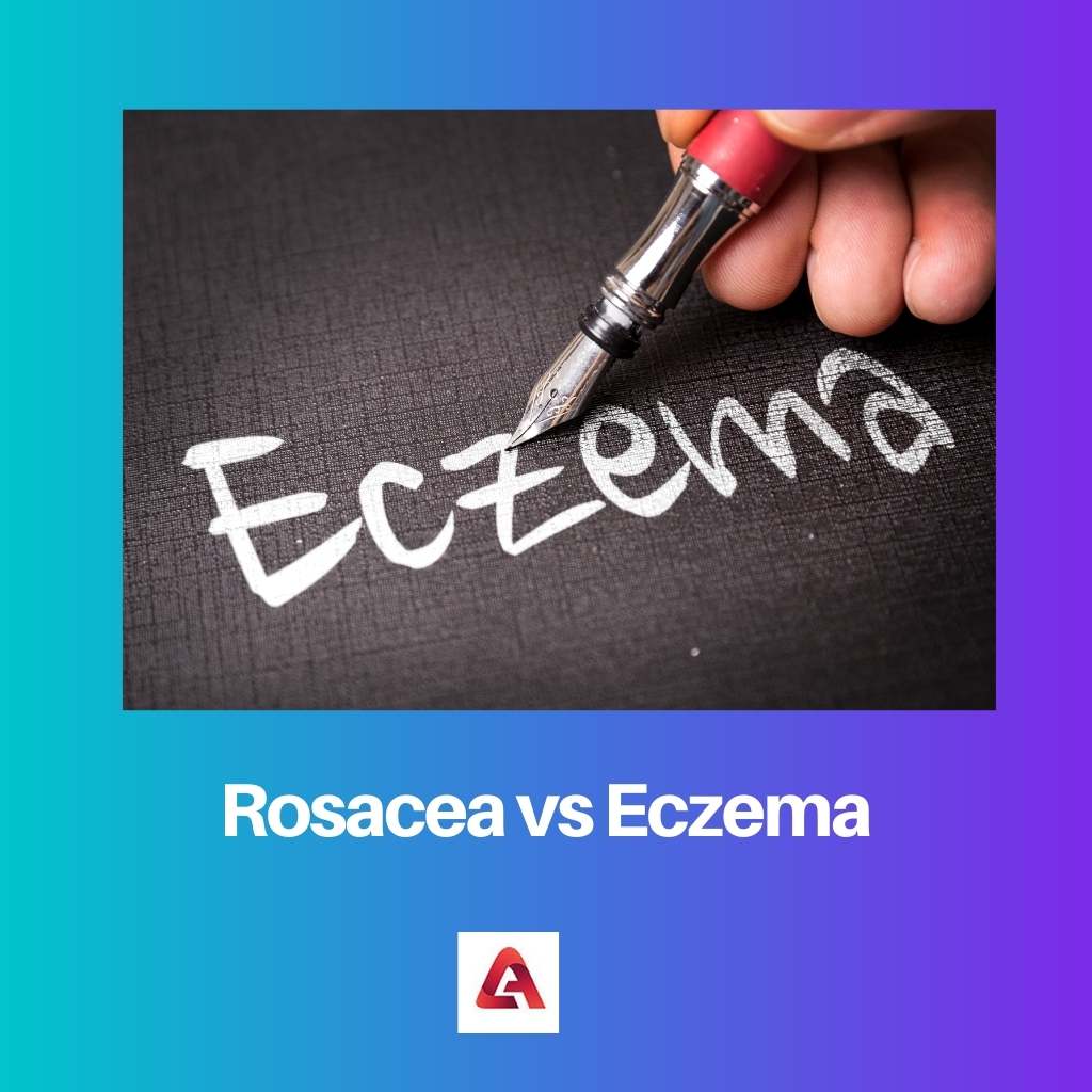 Rosacea Vs Eczema Difference And Comparison 6915