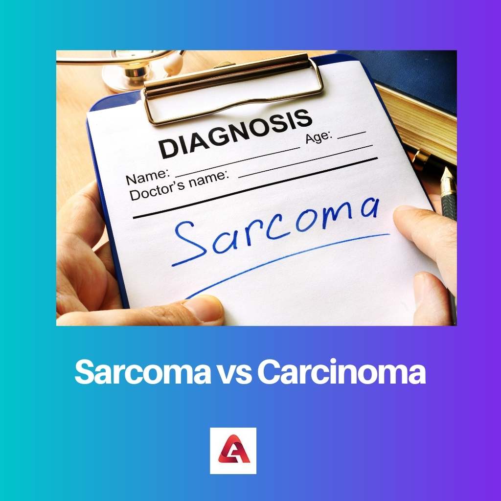 Sarcoma vs Carcinoma