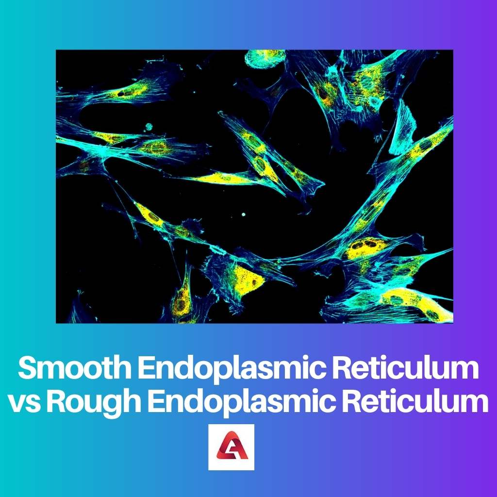 Smooth Endoplasmic Reticulum vs Rough Endoplasmic Reticulum