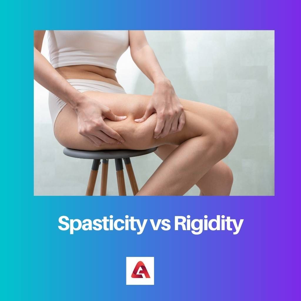 Spasticity vs Rigidity