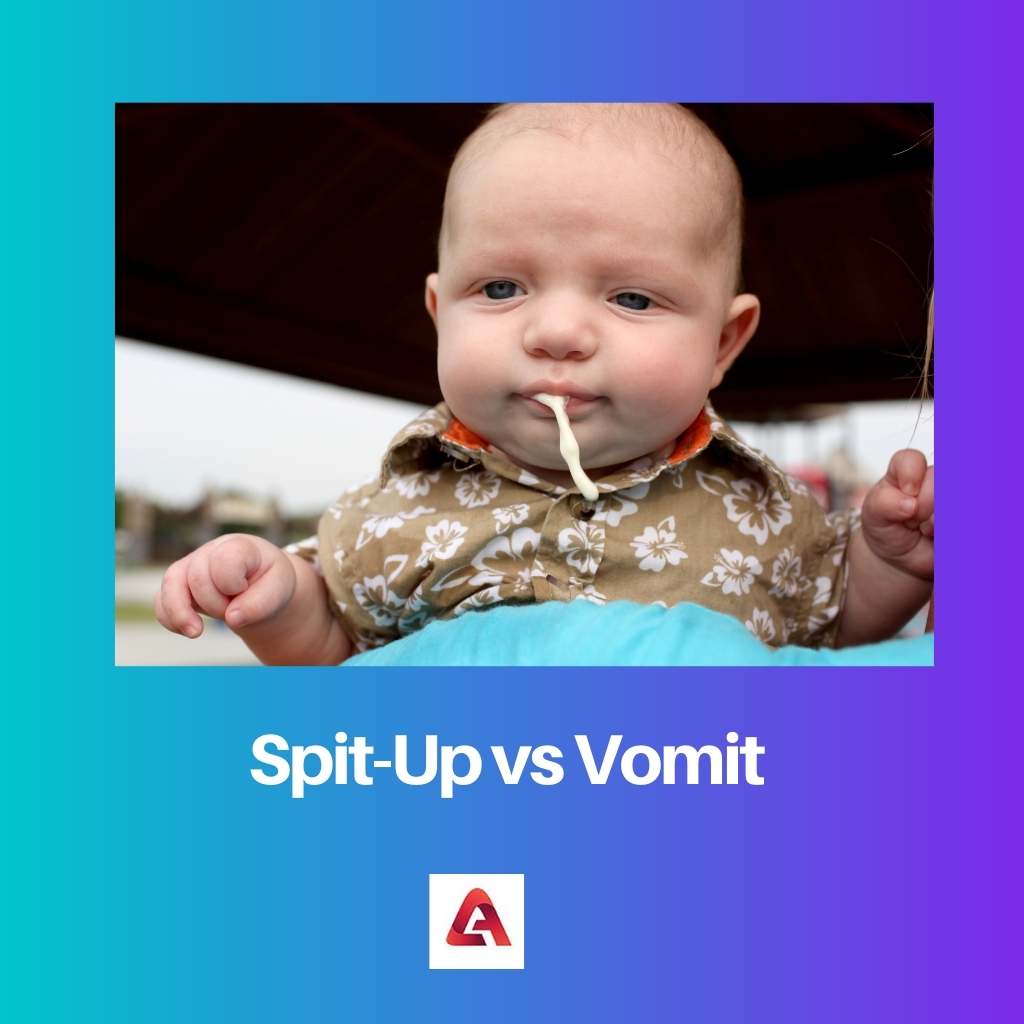 Spit Up vs Vomit