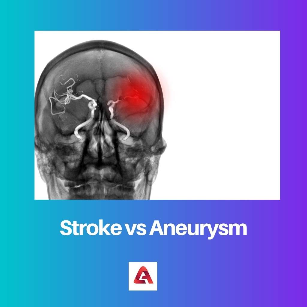Stroke vs Aneurysm