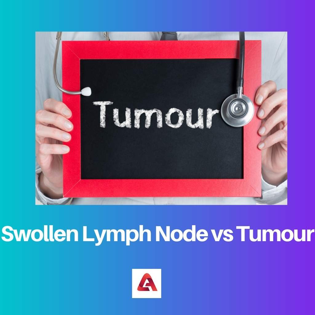 Swollen Lymph Node vs Tumour
