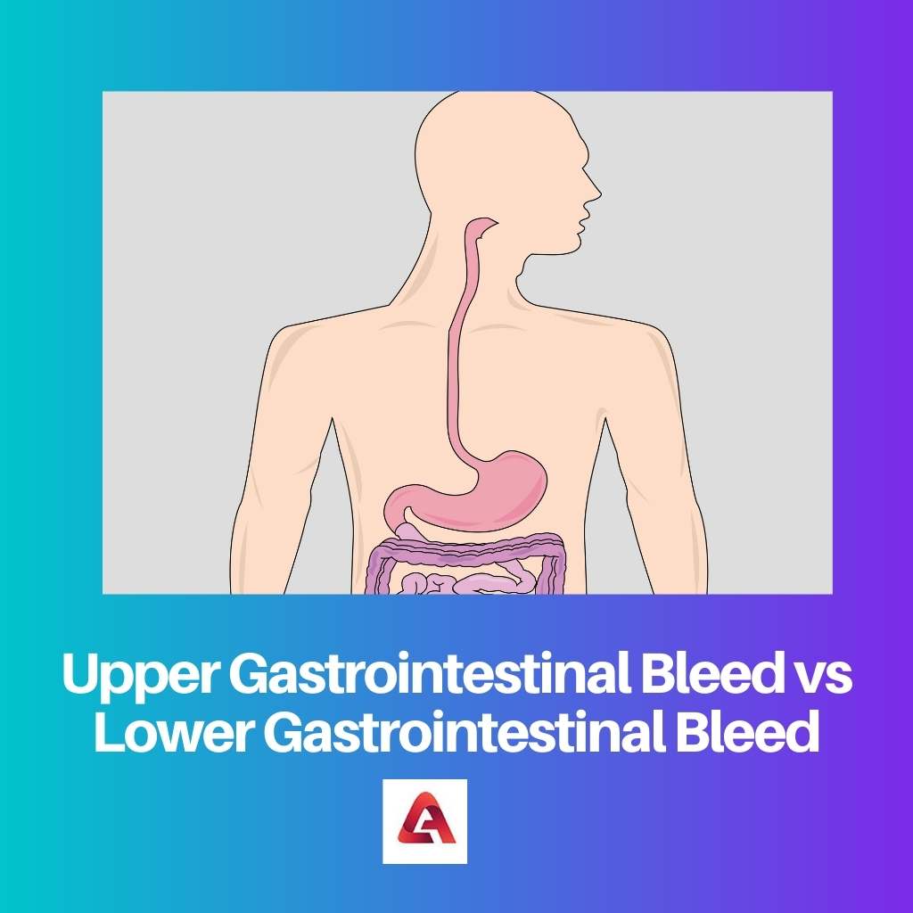Upper Gastrointestinal Bleed vs Lower Gastrointestinal Bleed