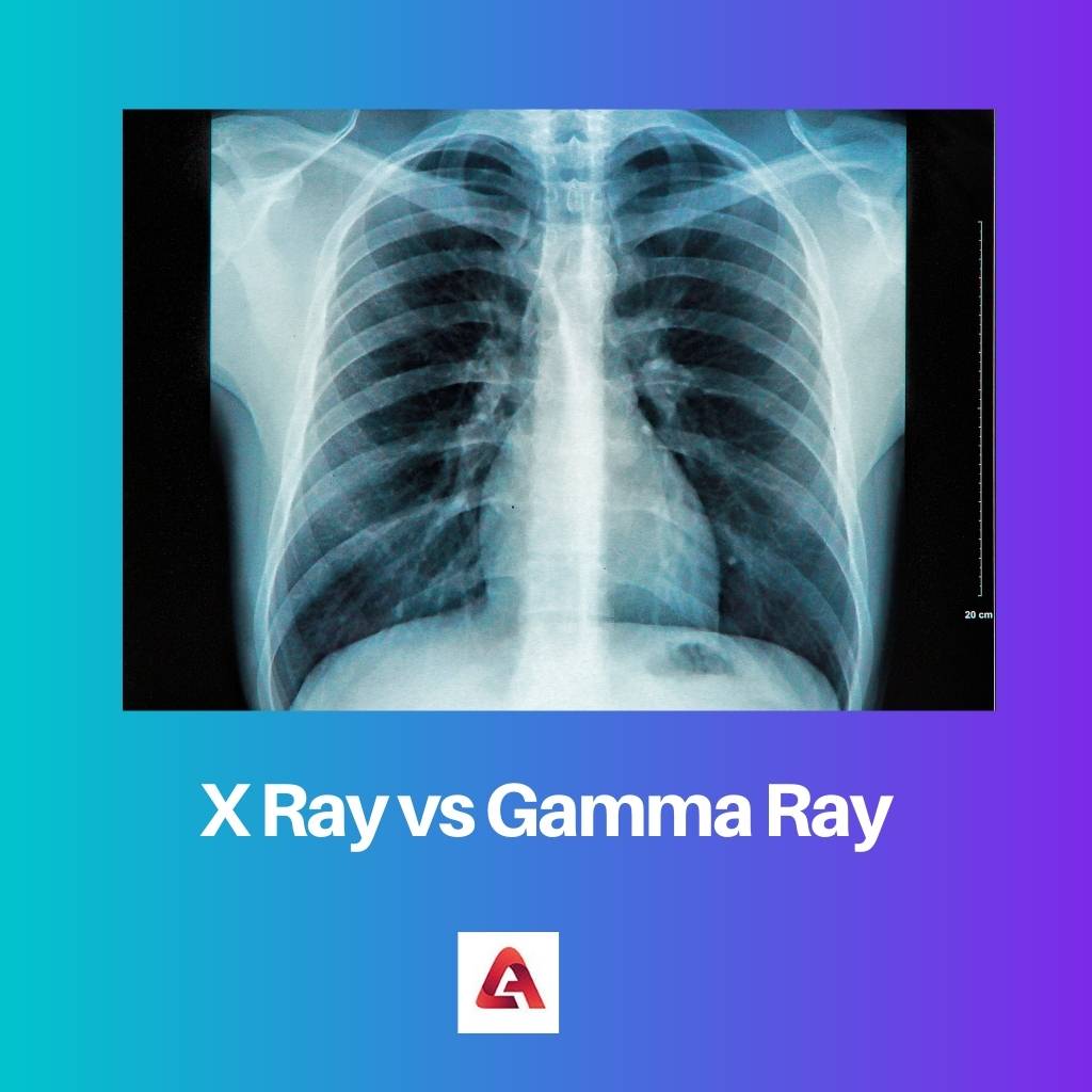 X Ray vs Gamma Ray