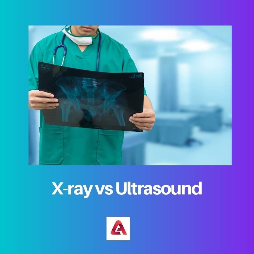 X ray vs Ultrasound
