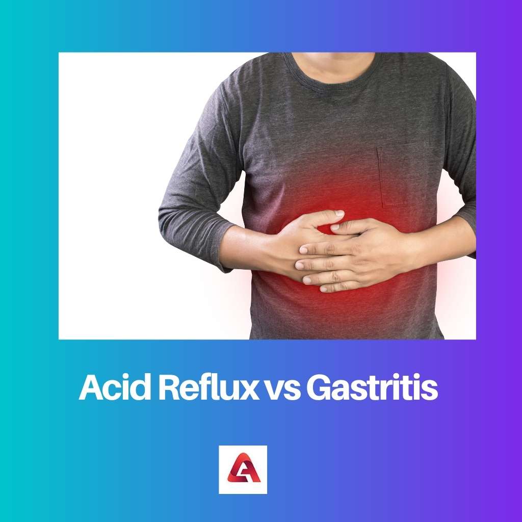Acid Reflux vs Gastritis