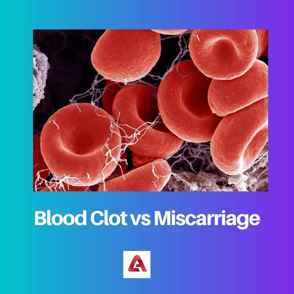 Blood Clot vs Miscarriage