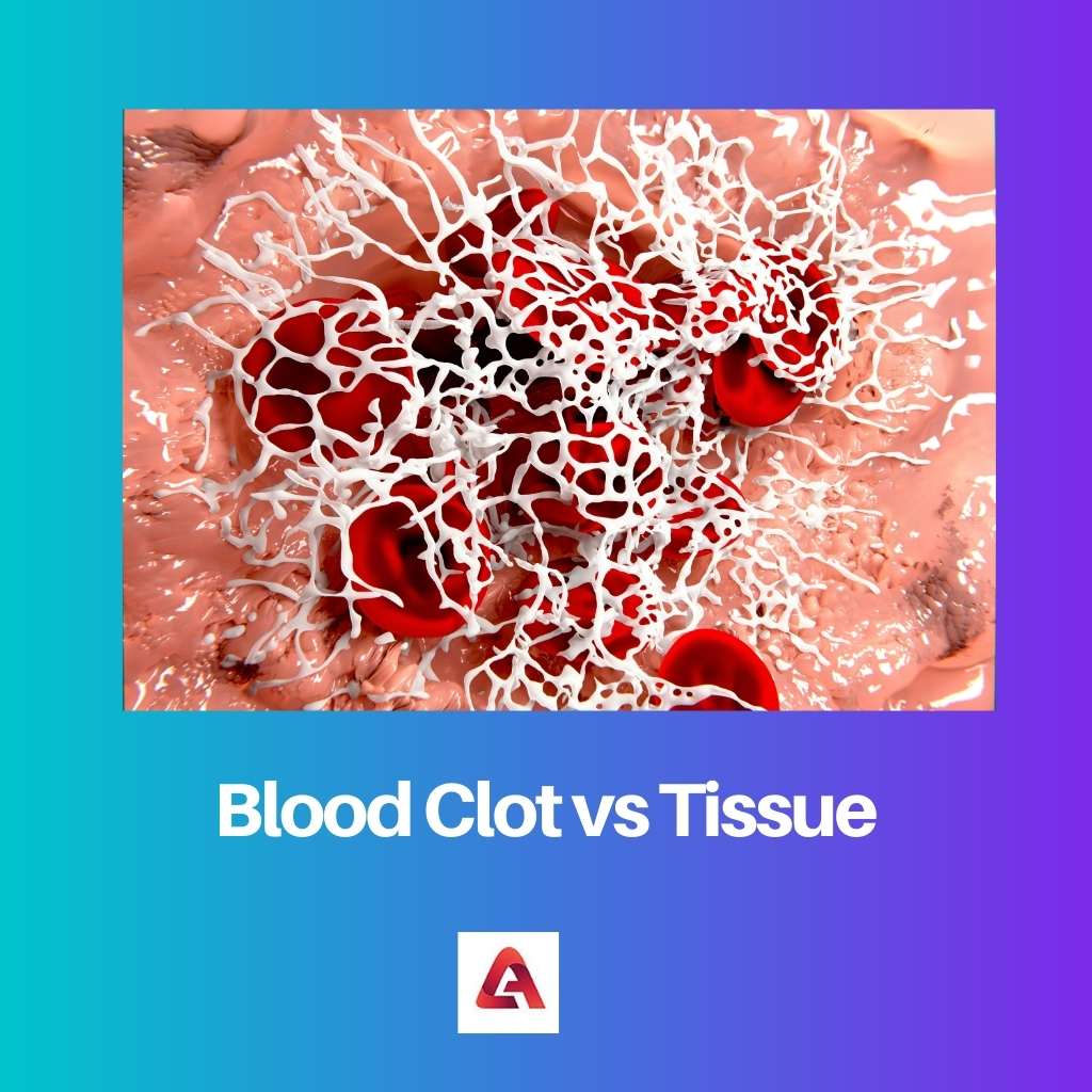 Blood Clot vs Tissue