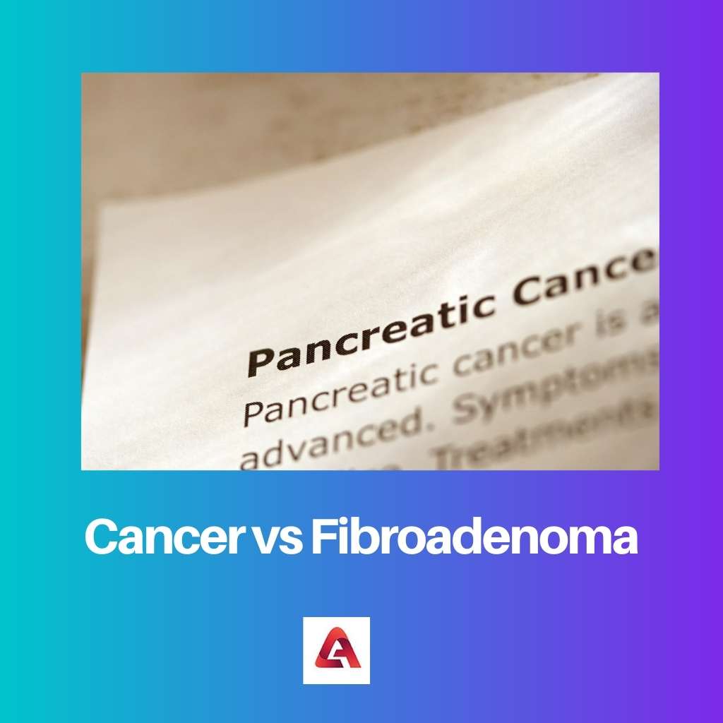Cancer vs Fibroadenoma