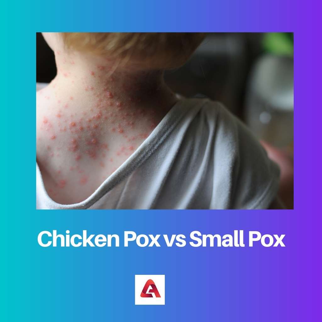 Chicken Pox vs Small