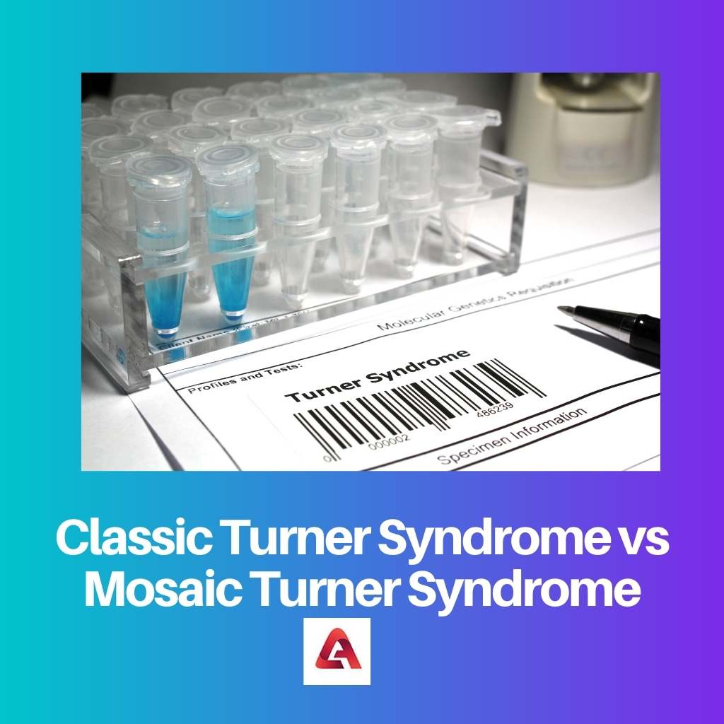 Classic Turner Syndrome vs Mosaic Turner Syndrome