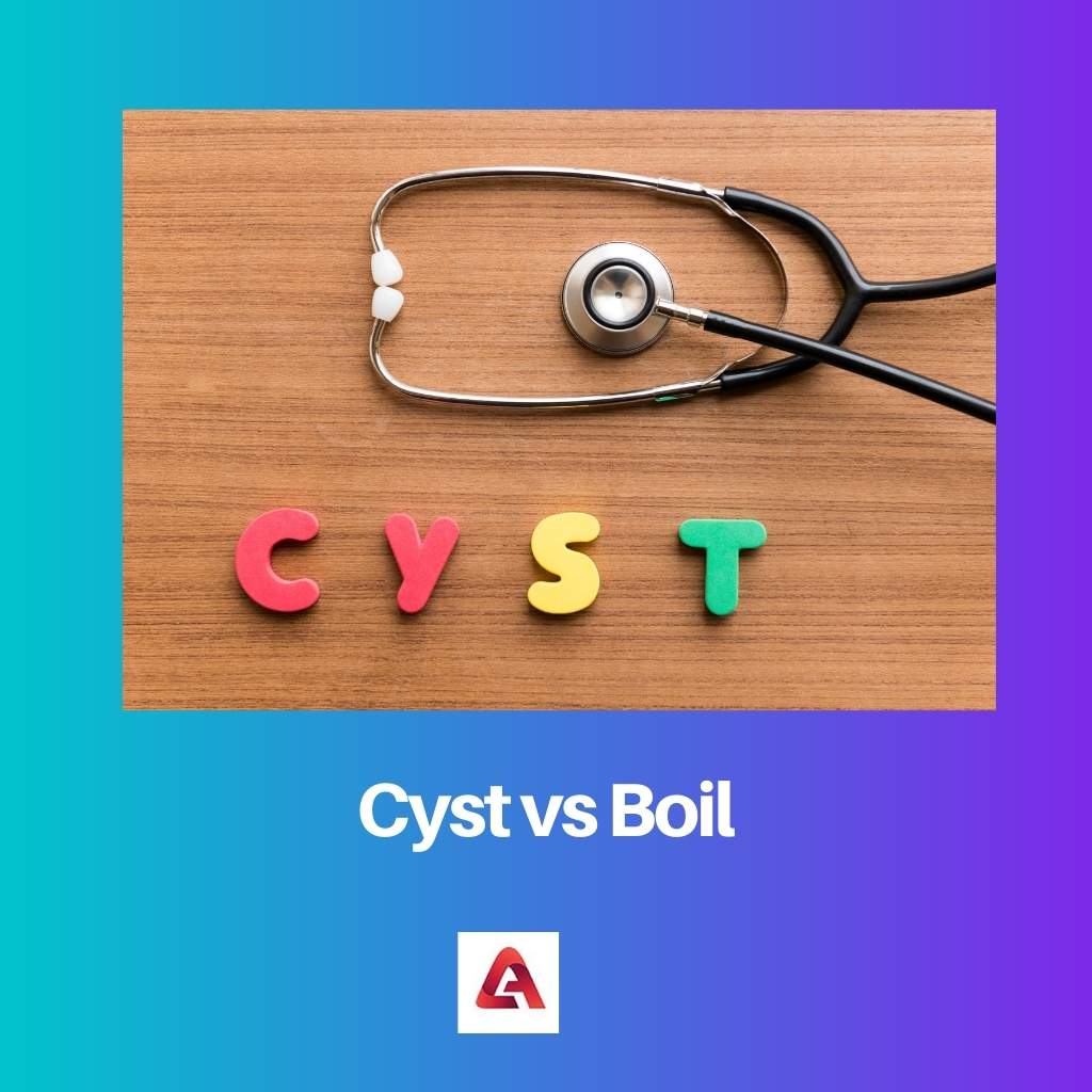Cyst vs Boil