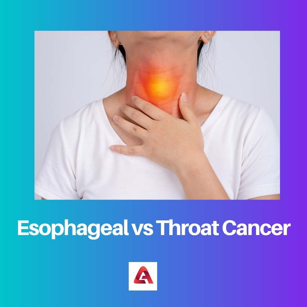 Esophageal vs Throat Cancer