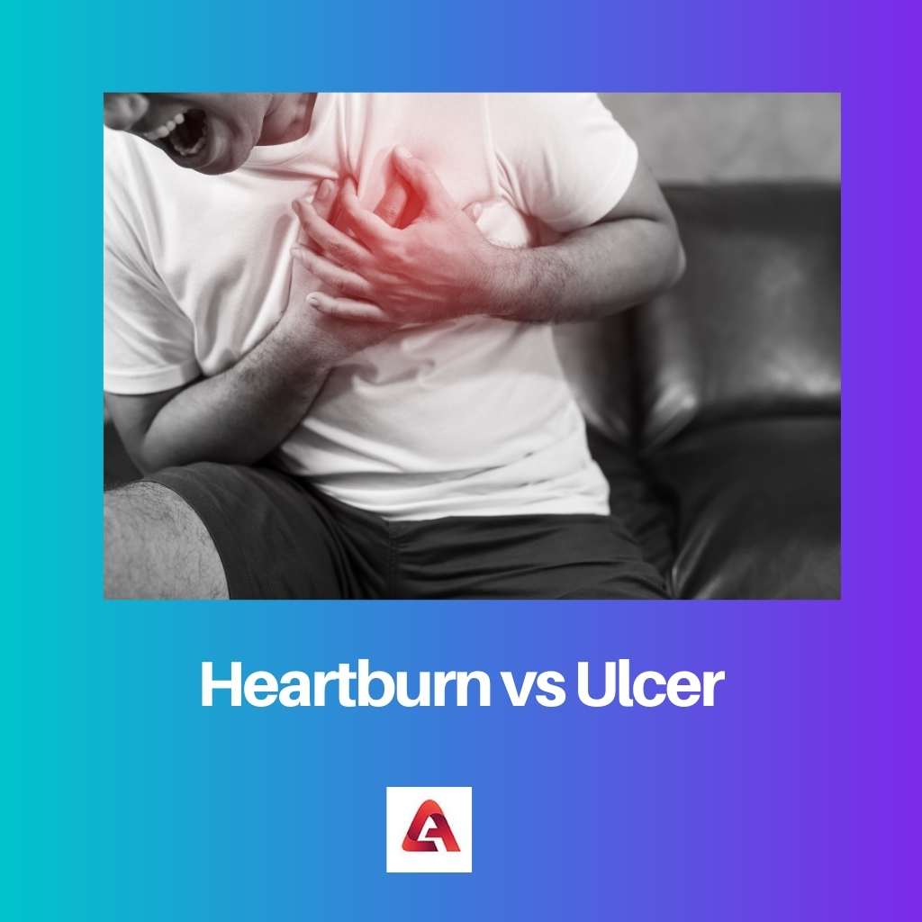 Heartburn vs Ulcer