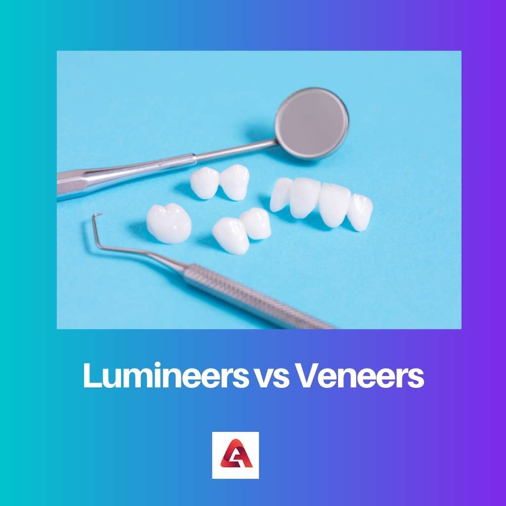 Lumineers vs Veneers