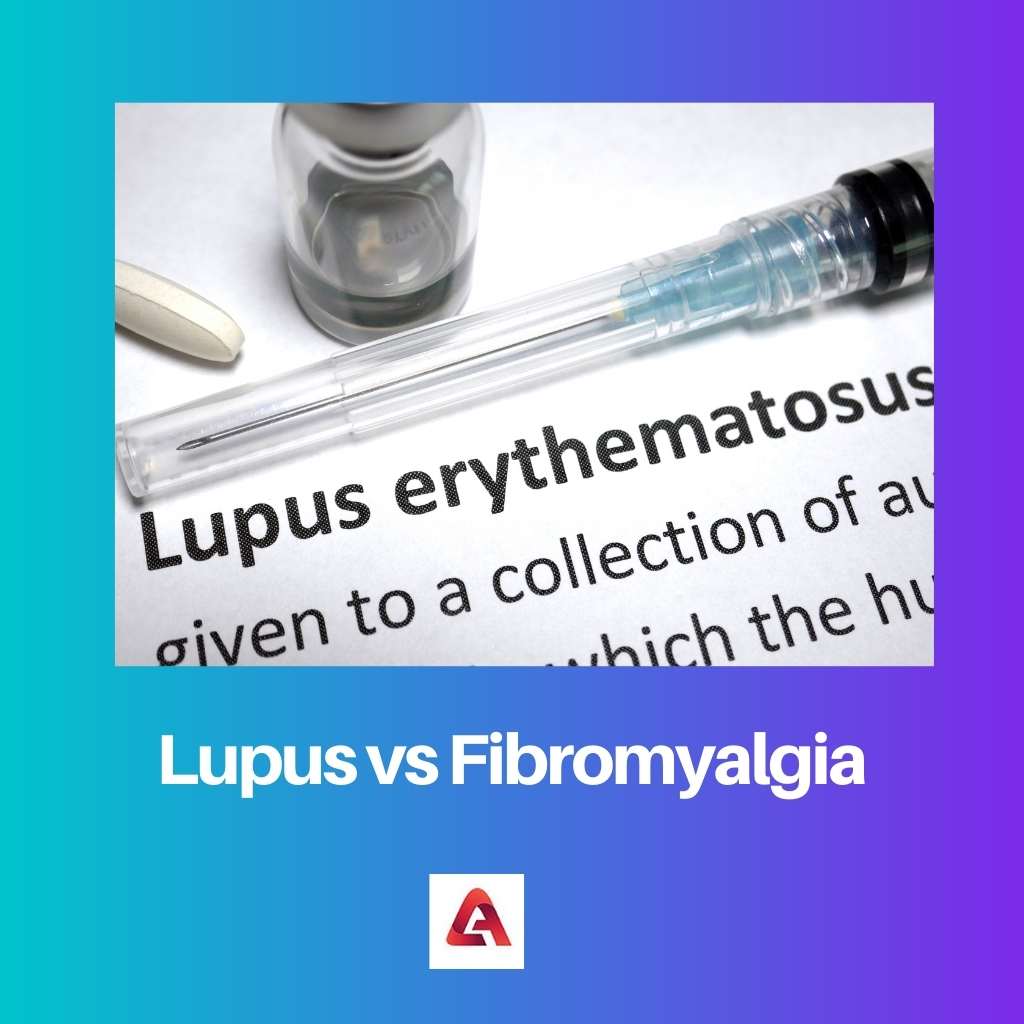 Lupus vs Fibromyalgia