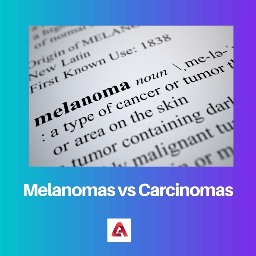 Melanomas vs Carcinomas