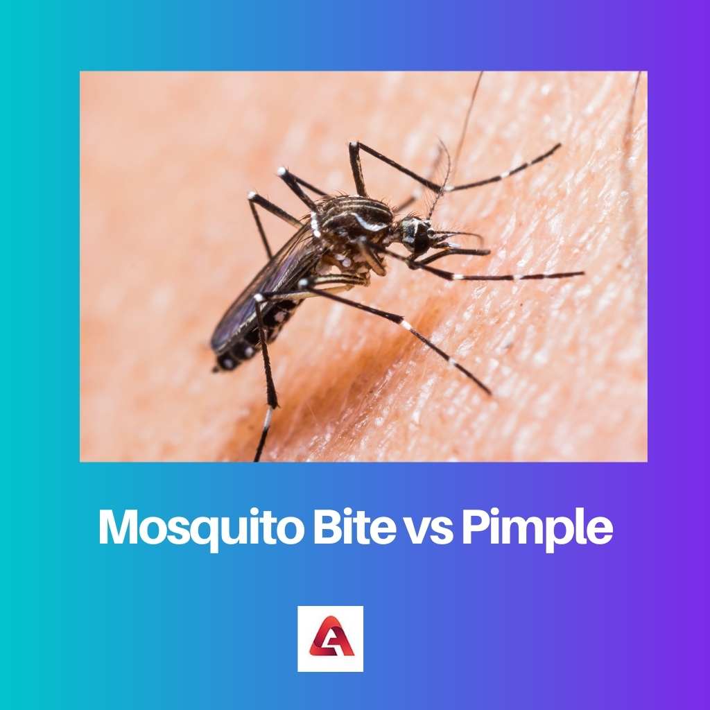 Mosquito Bite vs Pimple