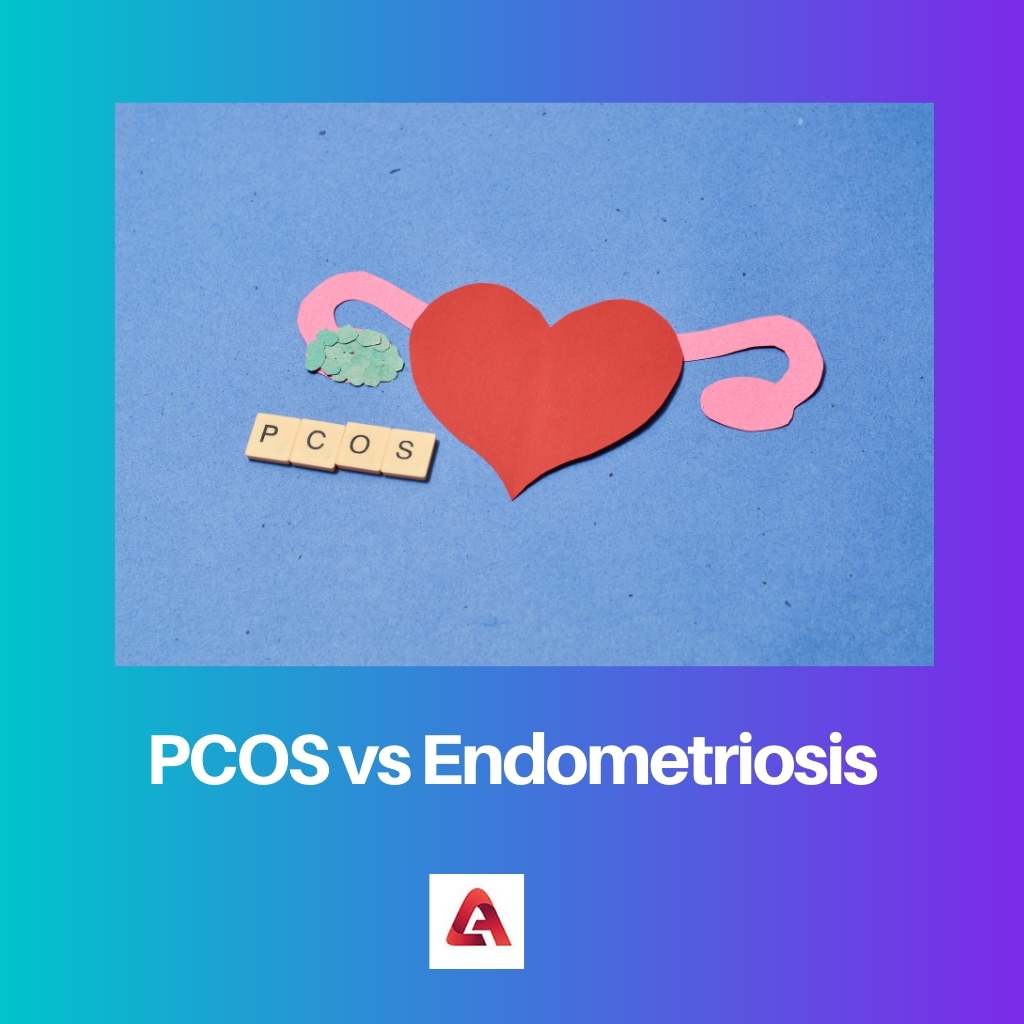 PCOS vs Endometriosis