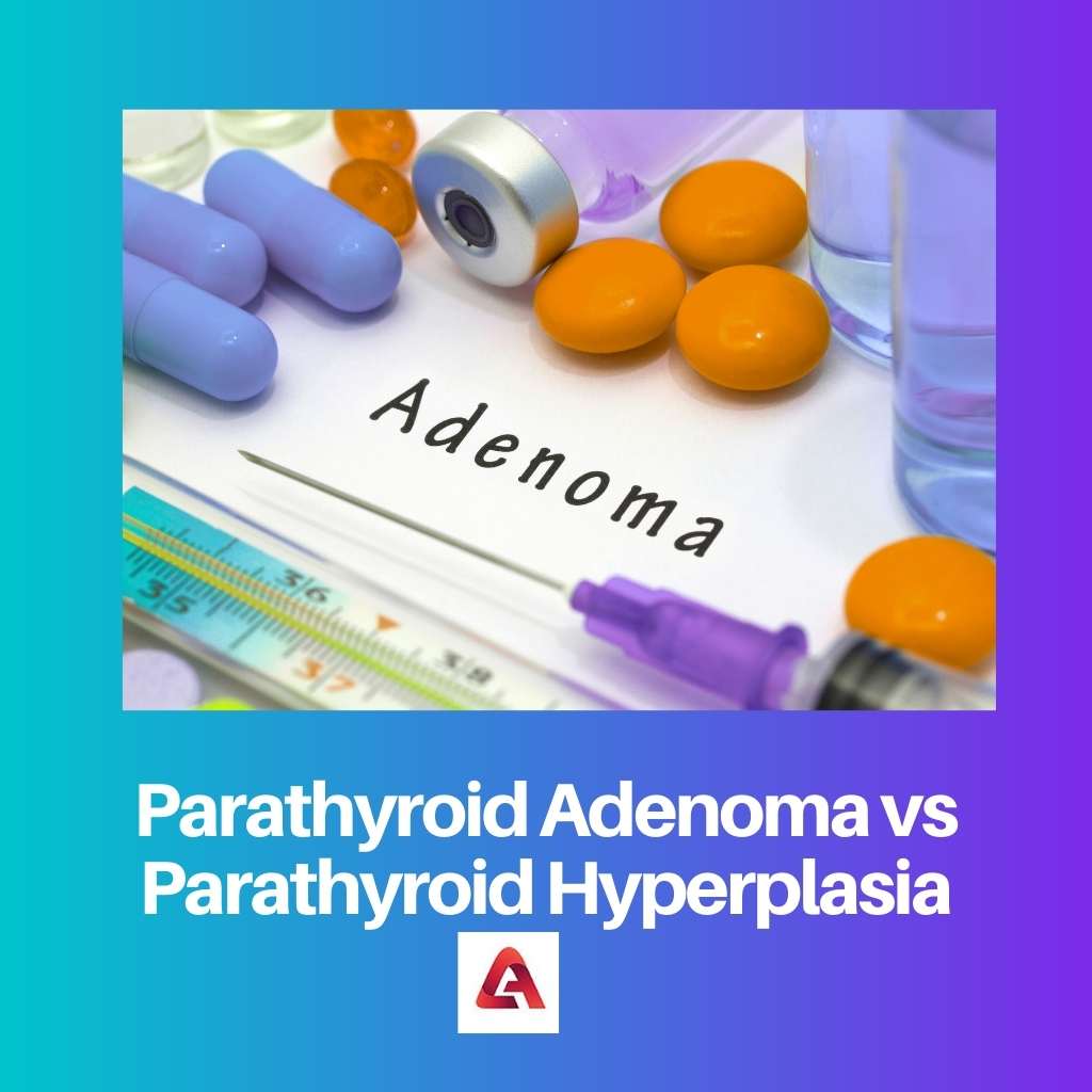Parathyroid Adenoma vs Parathyroid Hyperplasia