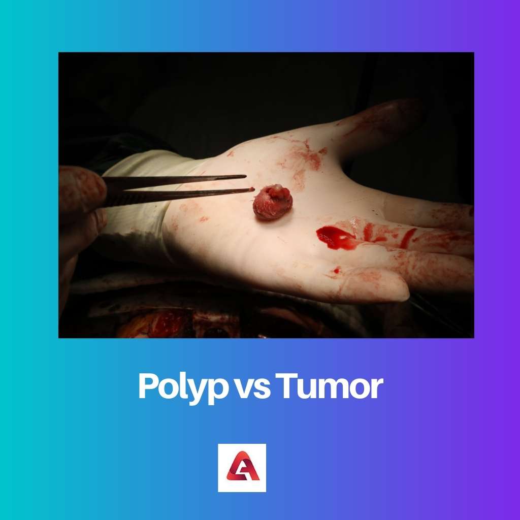 Polyp vs Tumor