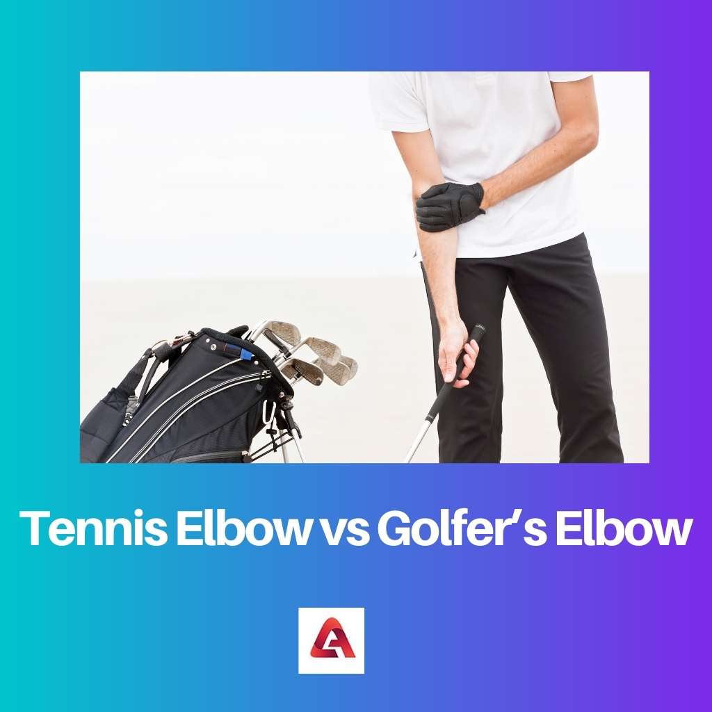 Tennis Elbow vs Golfers Elbow