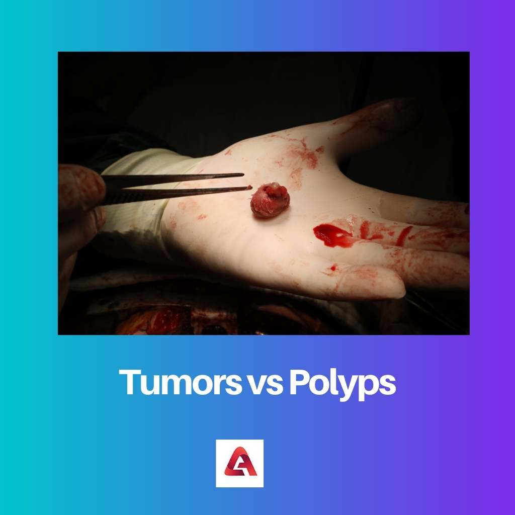 Tumors vs Polyps