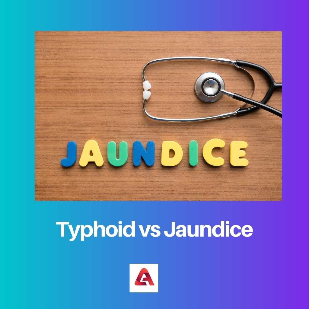 Typhoid vs Jaundice