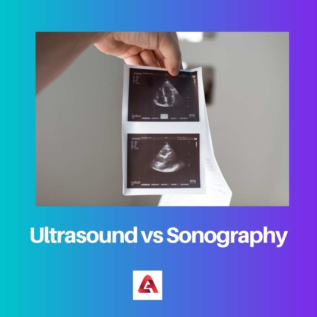 Ultrasound vs Sonography