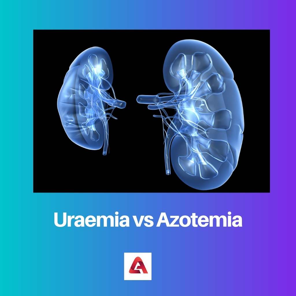 Uraemia vs Azotemia