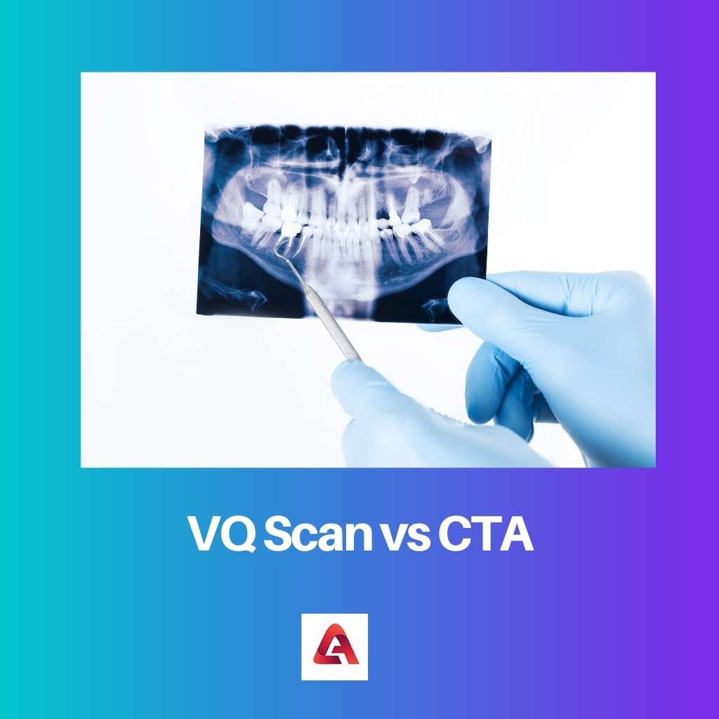 VQ Scan vs CTA